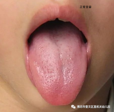 小孩舌苔厚白是怎么回事_厚小孩回事舌苔白是什么原因_厚小孩回事舌苔白是上火嗎