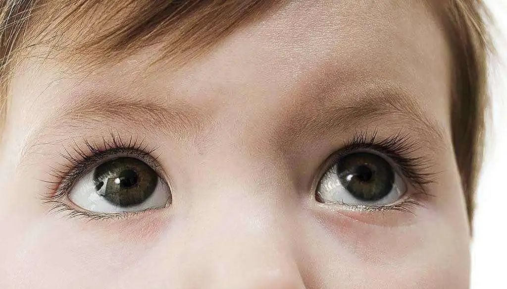 頻繁眨眼兒童_眼睛一直眨小孩_小孩子眼睛眨得很頻繁是什么原因